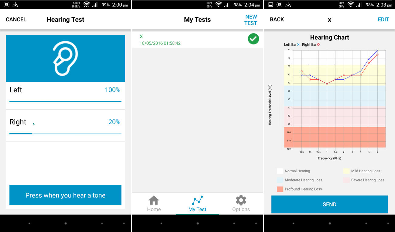 Quadio Q+ Hearing Test & Results